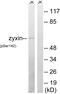 Zyxin antibody, PA5-39823, Invitrogen Antibodies, Western Blot image 