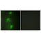 Autoimmune Regulator antibody, A00558, Boster Biological Technology, Immunohistochemistry paraffin image 