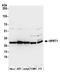 Hypoxanthine-guanine phosphoribosyltransferase antibody, A305-306A, Bethyl Labs, Western Blot image 