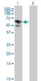 Biotinidase antibody, H00000686-M01, Novus Biologicals, Western Blot image 