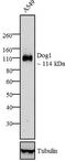 BRCA1 Interacting Protein C-Terminal Helicase 1 antibody, MA5-12648, Invitrogen Antibodies, Western Blot image 