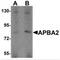 Amyloid Beta Precursor Protein Binding Family A Member 2 antibody, MBS150084, MyBioSource, Western Blot image 