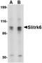 SLIT And NTRK Like Family Member 6 antibody, orb74943, Biorbyt, Western Blot image 