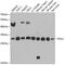 6-Phosphogluconolactonase antibody, GTX33407, GeneTex, Western Blot image 