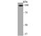 Actinin Alpha 2 antibody, NBP2-76889, Novus Biologicals, Western Blot image 