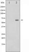 M-phase inducer phosphatase 2 antibody, TA325331, Origene, Western Blot image 