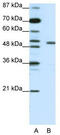 Potassium Voltage-Gated Channel Subfamily A Regulatory Beta Subunit 2 antibody, TA331457, Origene, Western Blot image 