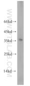 Homeobox protein TGIF2LX antibody, 17405-1-AP, Proteintech Group, Western Blot image 