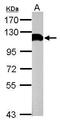 Ubiquitin carboxyl-terminal hydrolase 13 antibody, GTX118595, GeneTex, Western Blot image 