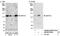 Zinc Finger Protein 574 antibody, NB100-97825, Novus Biologicals, Western Blot image 