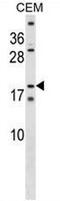SSX Family Member 4B antibody, AP54055PU-N, Origene, Western Blot image 