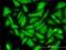 DCN1-like protein 1 antibody, H00054165-M01, Novus Biologicals, Immunocytochemistry image 