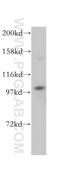 Complement component C7 antibody, 17642-1-AP, Proteintech Group, Western Blot image 