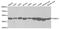 Proteasome 26S Subunit, ATPase 4 antibody, A2505, ABclonal Technology, Western Blot image 