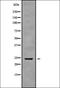 Probable alpha-ketoglutarate-dependent dioxygenase ABH7 antibody, orb337870, Biorbyt, Western Blot image 