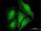 LIM domain only protein 3 antibody, H00055885-M07, Novus Biologicals, Immunofluorescence image 
