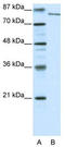 Lysine Demethylase 2A antibody, TA329390, Origene, Western Blot image 