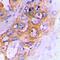 ATP Binding Cassette Subfamily B Member 10 antibody, GTX54895, GeneTex, Immunohistochemistry paraffin image 