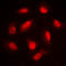 LIM domain kinase 1 antibody, LS-C352450, Lifespan Biosciences, Immunofluorescence image 