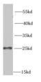 Methionine Sulfoxide Reductase A antibody, FNab05382, FineTest, Western Blot image 
