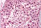 Dicer 1, Ribonuclease III antibody, MBS246728, MyBioSource, Immunohistochemistry frozen image 