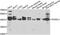 SH3 Domain Containing GRB2 Like 1, Endophilin A2 antibody, A05946, Boster Biological Technology, Western Blot image 
