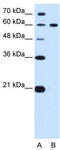 Deltex E3 Ubiquitin Ligase 2 antibody, TA330457, Origene, Western Blot image 