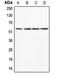 Abl Interactor 1 antibody, LS-C353220, Lifespan Biosciences, Western Blot image 