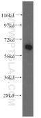 Phenylalanyl-TRNA Synthetase Subunit Beta antibody, 16341-1-AP, Proteintech Group, Western Blot image 