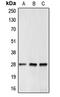 BCL2 antibody, LS-C351894, Lifespan Biosciences, Western Blot image 