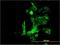 Centromere Protein K antibody, H00064105-M01, Novus Biologicals, Immunocytochemistry image 