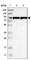 Polypeptide N-Acetylgalactosaminyltransferase 8 antibody, HPA012638, Atlas Antibodies, Western Blot image 