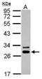 Deoxycytidine kinase antibody, TA308454, Origene, Western Blot image 