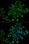 Fibroblast Growth Factor Receptor 1 antibody, 15-021, ProSci, Immunofluorescence image 