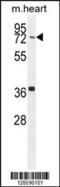 Coiled-coil domain-containing protein 38 antibody, 55-308, ProSci, Western Blot image 