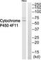 Cytochrome P450 Family 4 Subfamily F Member 11 antibody, TA315687, Origene, Western Blot image 