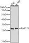 E3 ubiquitin-protein ligase RNF125 antibody, LS-C750136, Lifespan Biosciences, Western Blot image 