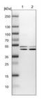 Receptor Associated Protein Of The Synapse antibody, NBP1-85537, Novus Biologicals, Western Blot image 