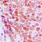 p21 antibody, LS-C354620, Lifespan Biosciences, Immunohistochemistry paraffin image 