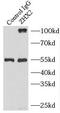 Zinc Fingers And Homeoboxes 2 antibody, FNab09636, FineTest, Immunoprecipitation image 