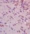 Microtubule Associated Protein Tau antibody, orb11451, Biorbyt, Immunohistochemistry paraffin image 