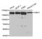 NBR1 Autophagy Cargo Receptor antibody, abx002887, Abbexa, Western Blot image 