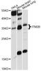 Integral Membrane Protein 2B antibody, LS-C749805, Lifespan Biosciences, Western Blot image 