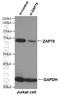 Zeta Chain Of T Cell Receptor Associated Protein Kinase 70 antibody, 15592-1-AP, Proteintech Group, Western Blot image 