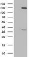 PIH1 Domain Containing 2 antibody, M16443, Boster Biological Technology, Western Blot image 