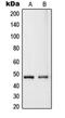 Ras association domain-containing protein 8 antibody, orb215048, Biorbyt, Western Blot image 