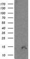 Cyclin Dependent Kinase Inhibitor 2B antibody, M01500-1, Boster Biological Technology, Western Blot image 