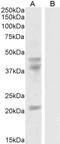 GA Binding Protein Transcription Factor Subunit Beta 1 antibody, NB100-60948, Novus Biologicals, Western Blot image 