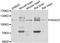 Histone Deacetylase 5 antibody, STJ113548, St John