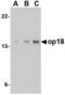 OP18 antibody, TA336822, Origene, Western Blot image 